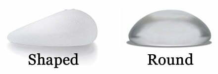 implant-comparison
