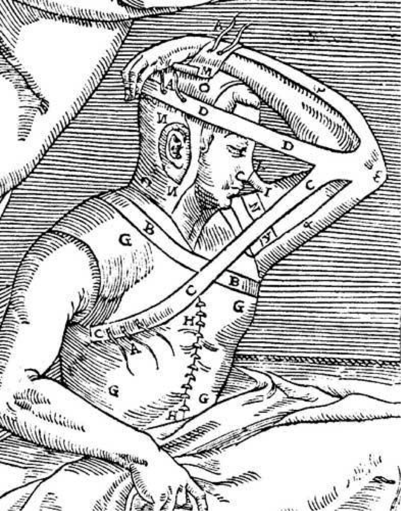 History of Plastic Surgery: Wars, Duels and Great Minds - Kirby